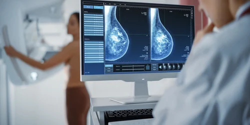 screening cancer mamar jpg