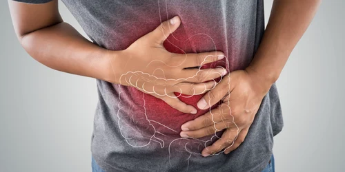 Cancer de colon FOTO Shutterstock jpg