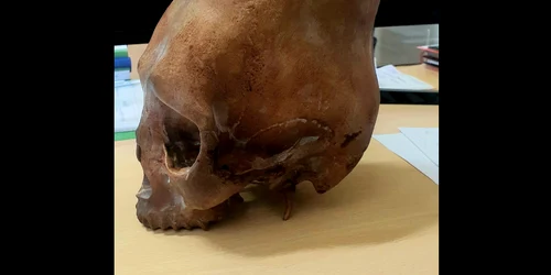 printesa cu craniul alungit FOTO Muzeul Buzau png